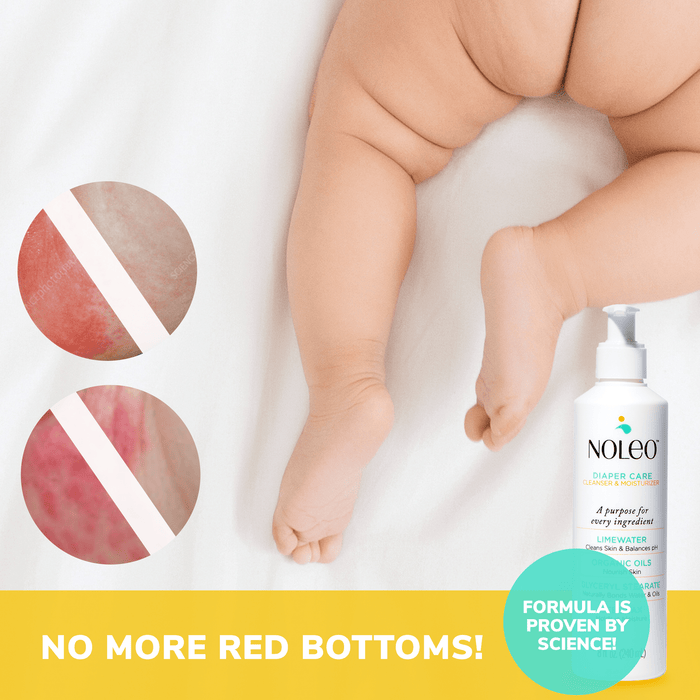 NOLEO 3-IN-1 - Diaper Rash Cream - EWG Verified Diaper Rash Treatment Cream > Baby Wipes > Liniment > Organic Baby Wipes > Baby Lotion > Cloth Diaper Safe Rash Cream M4A